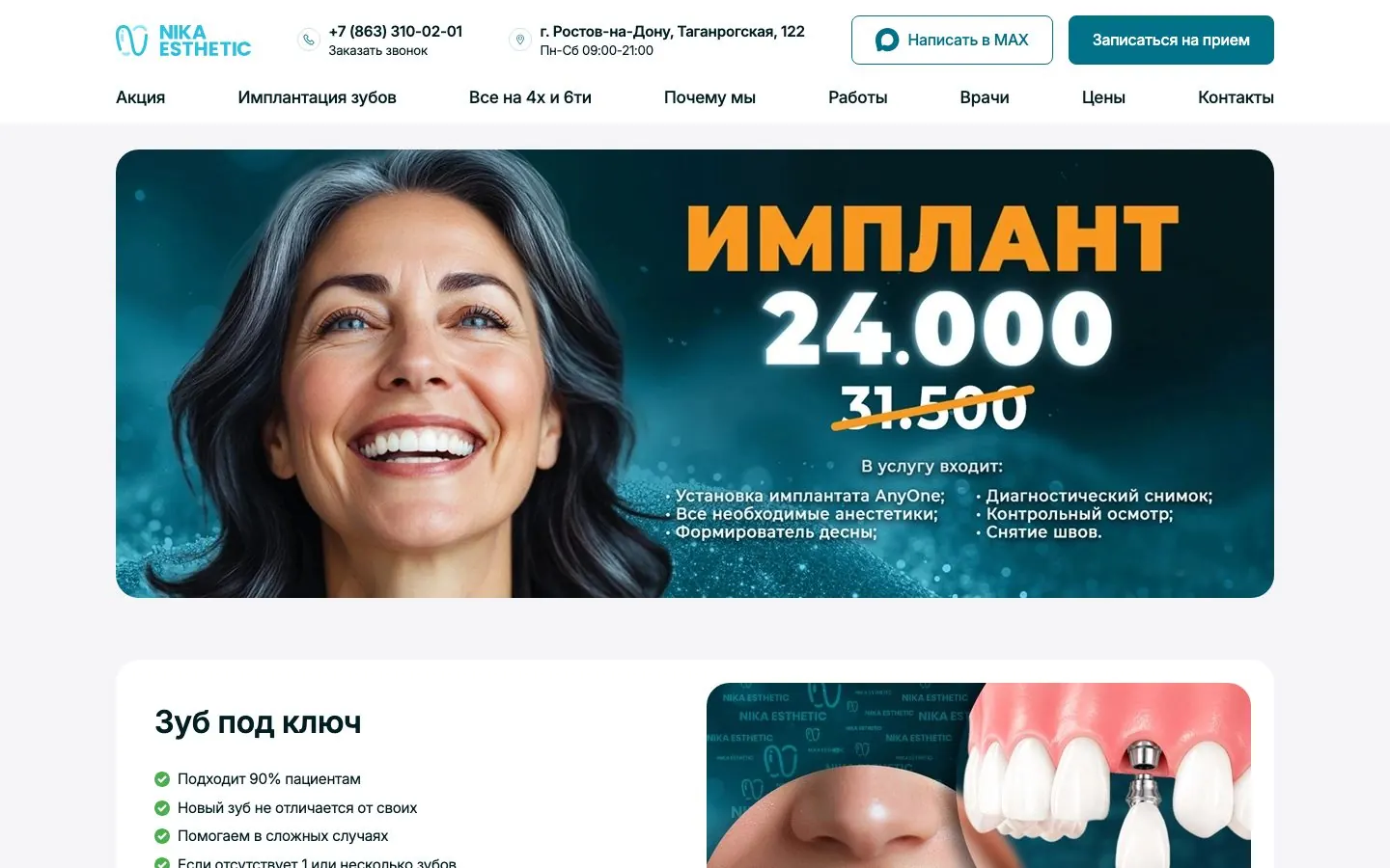 Nika Esthetic: имплантация
